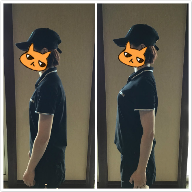 改善含胸驼背弹力带有用吗,弹力带含胸驼背改善训练