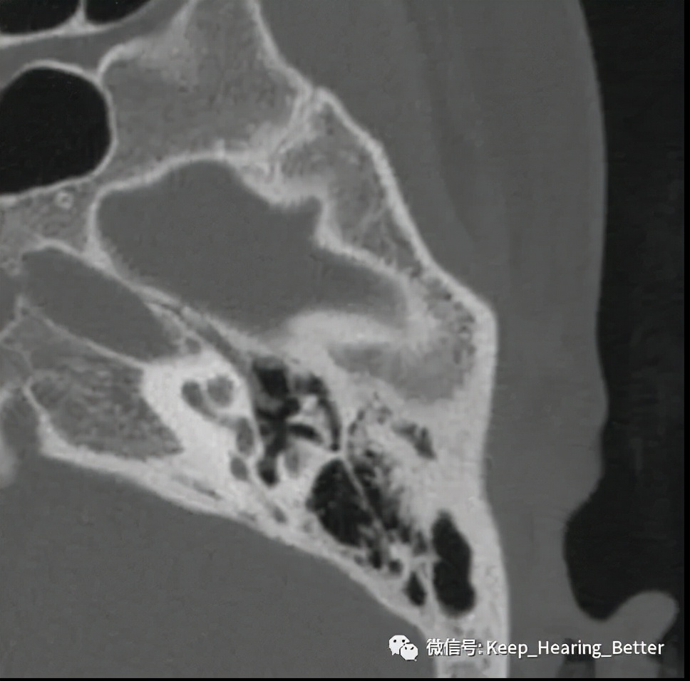 南大二附院,南大二附院耳鼻喉科专家