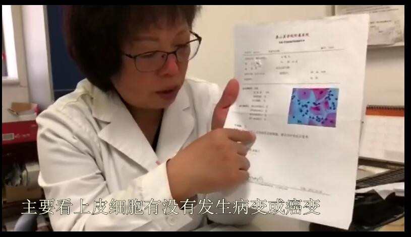 宫颈癌筛查tct轻度炎症严重吗,宫颈癌tct检查有炎症hpv16阳性