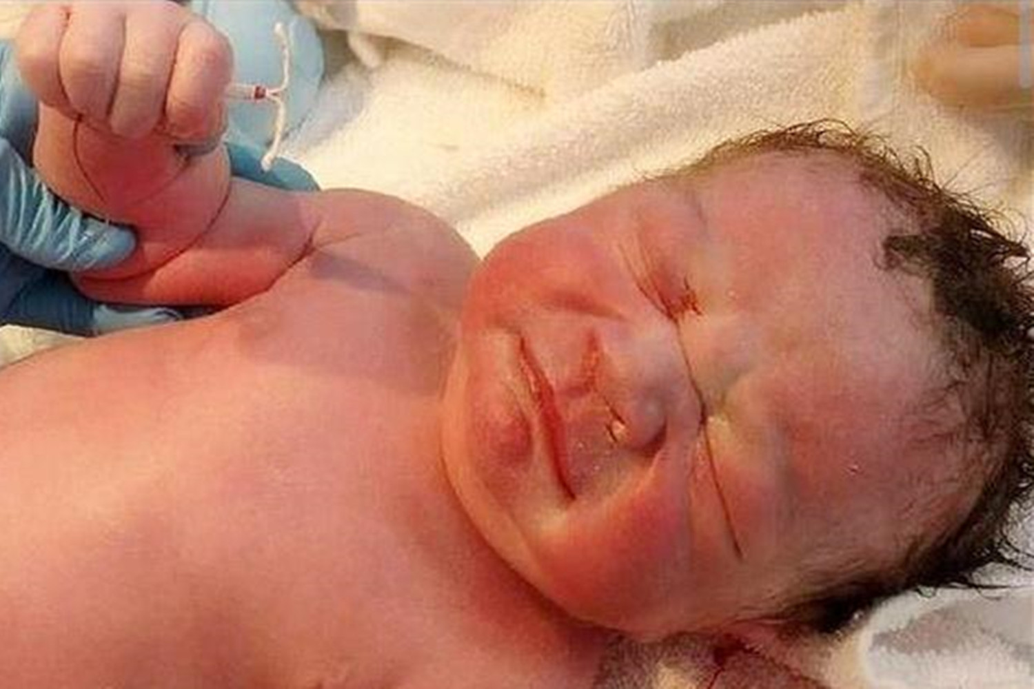 带环怀孕的宝宝能保下来吗,带环也会怀孕吗