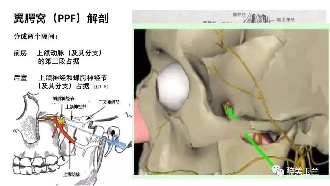 病例分享丨三叉神经节微球囊压迫术的麻醉管理