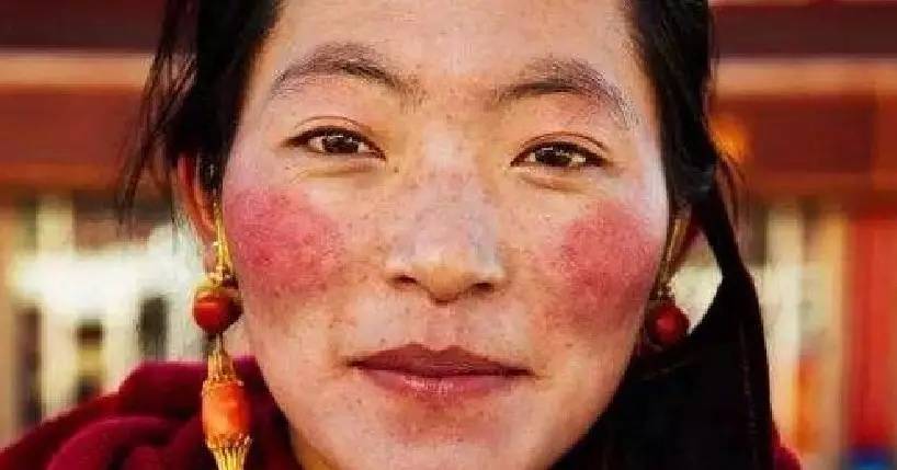 血丝出现原因,血丝红是怎么回事