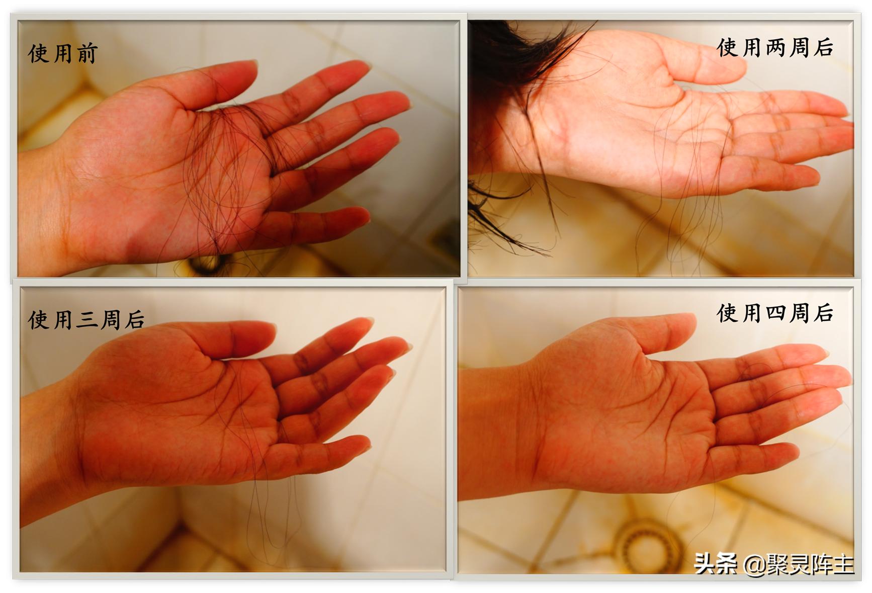 头发防脱产品排行榜 (头发控油防脱)