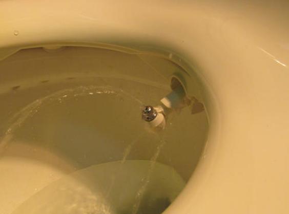 糖尿病痔疮痒得受不了怎么弄,中医肛肠主任教你痔疮肛裂小妙招