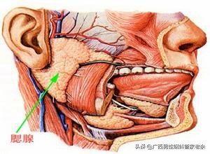 猪头肥是腮腺炎吗,你小时候得过腮腺炎吗