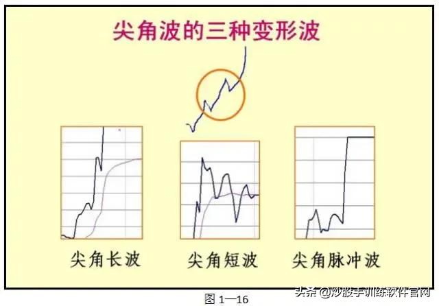 主力出逃还是布局,主力出货还是洗盘