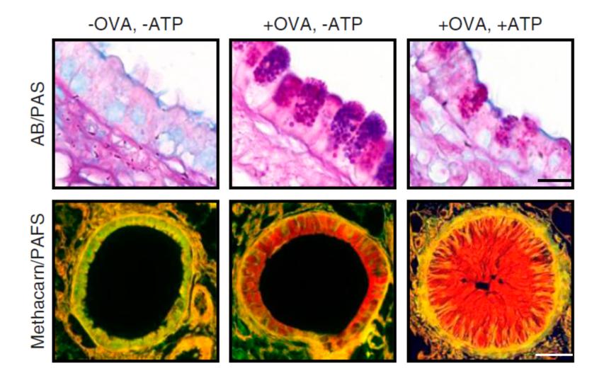 新冠肺炎对症用药指南,新冠肺炎的解读和总结