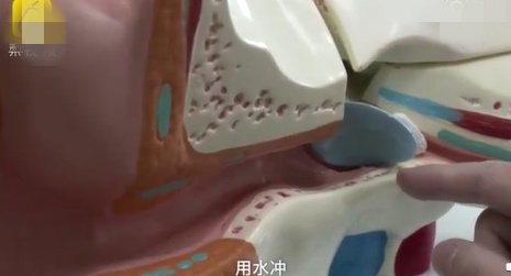 孩子被蚊虫叮咬怎么也不好怎么办,孩子被蚊虫叮咬几种方法辨别