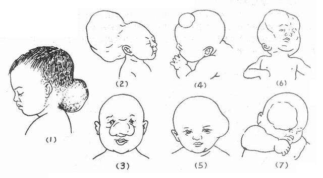 孕期吃爱乐维够补充叶酸量吗,癫痫孕妇孕期叶酸怎么补充