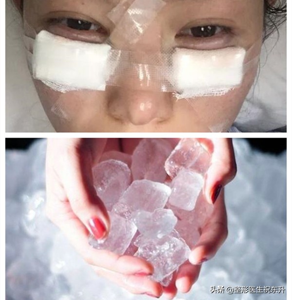 关于祛眼袋那点事,医生讲去眼袋是真的吗