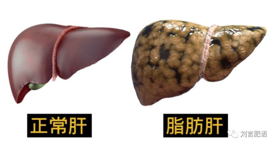 腰围决定寿命的视频,腰围粗影响寿命