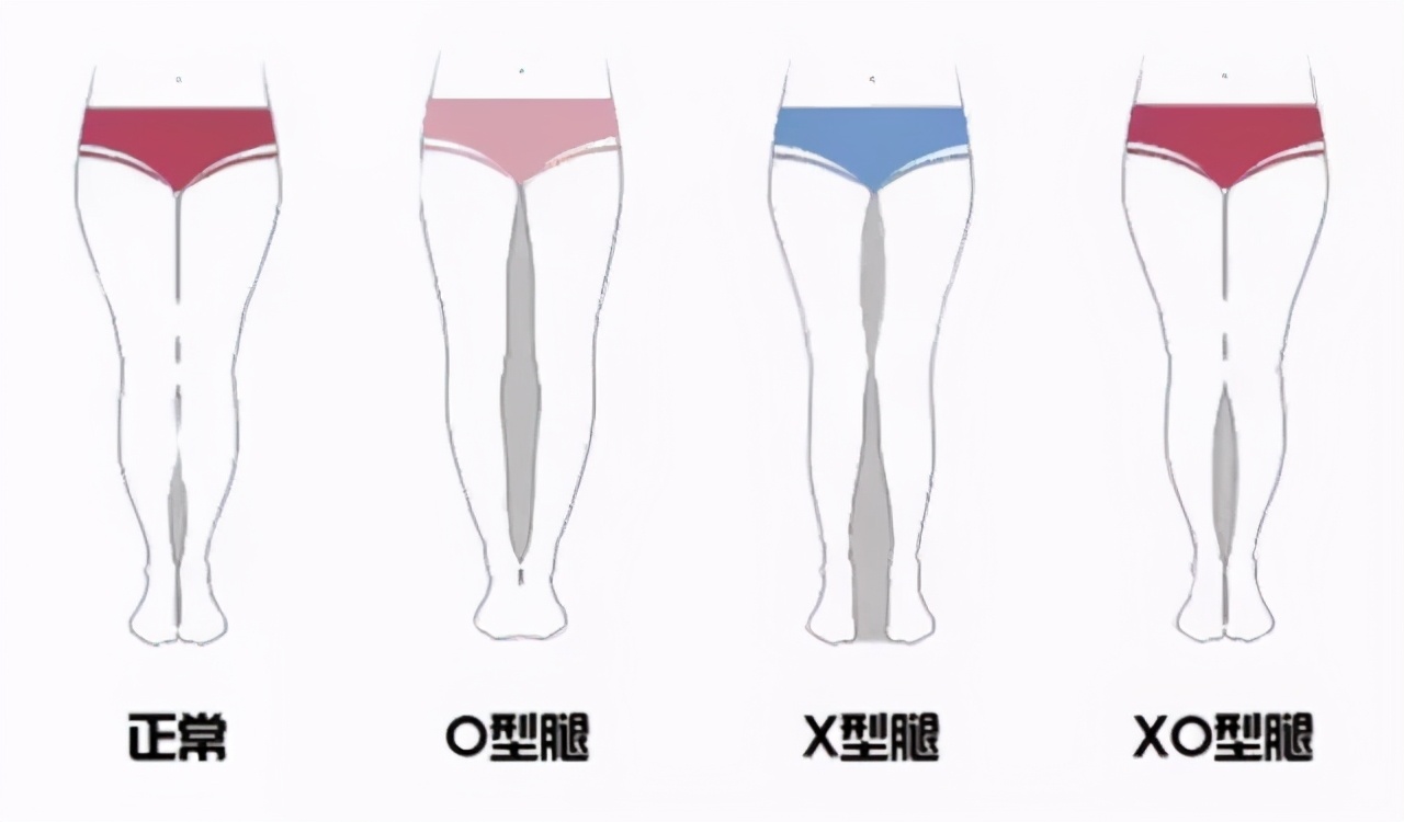 胯宽是因为腿短,腿粗胯宽腿型不直
