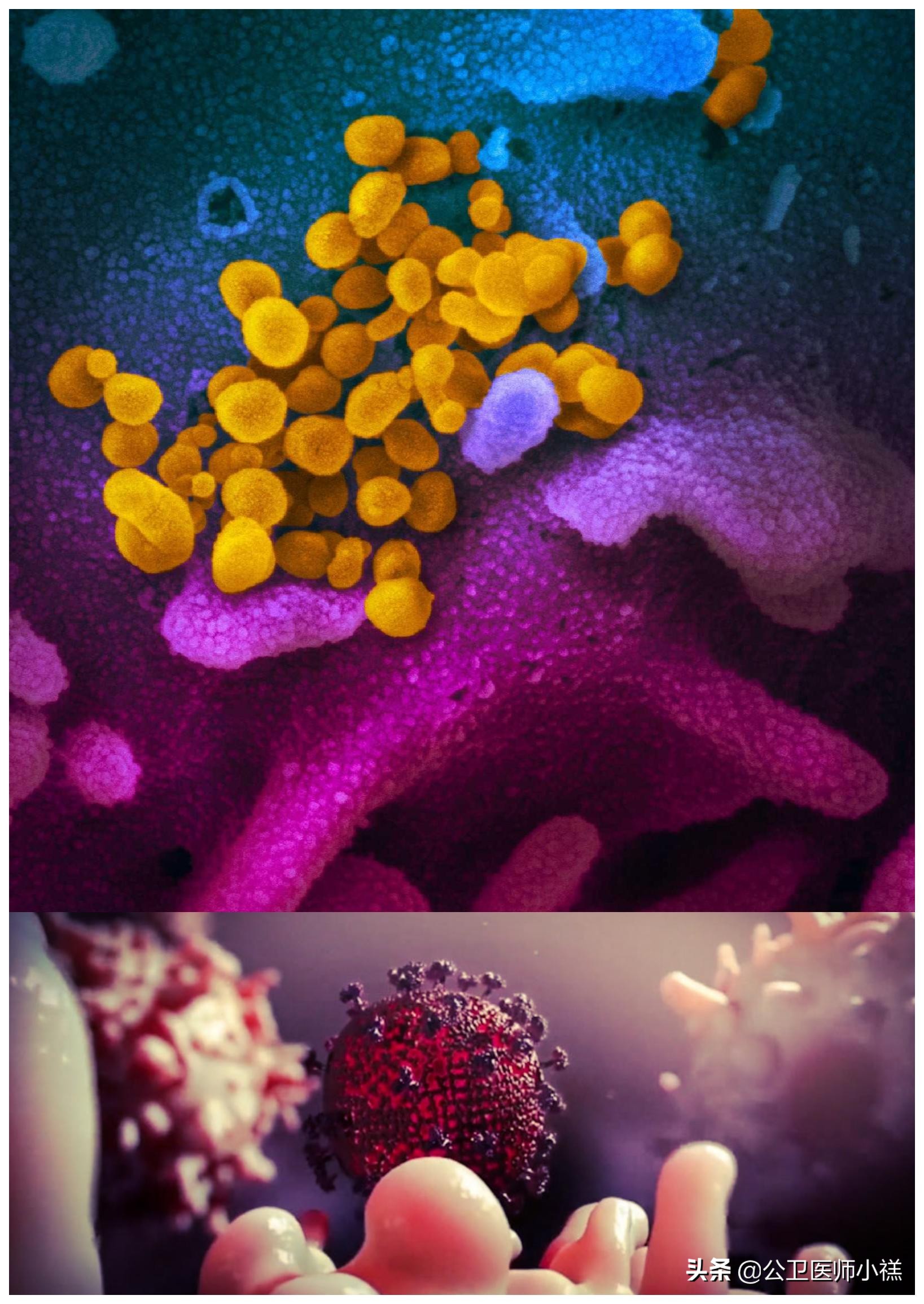 怀疑自己被新冠疫情感染了怎么办,新型冠状病毒疫情期间该如何预防