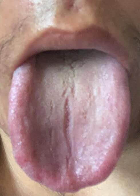 肾阳不足精关不固吃什么中成药,中医治疗精关不固疗效好吗