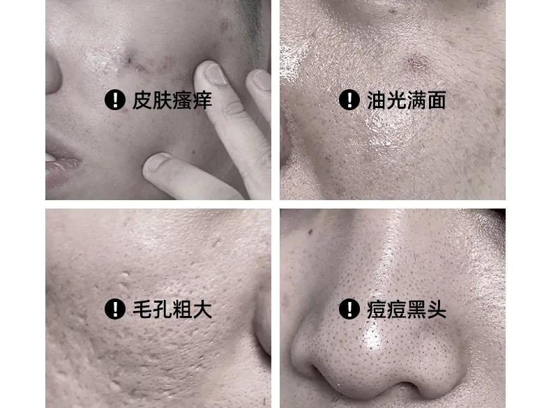 专为男士护肤洗面奶,专为男士除螨洗面奶