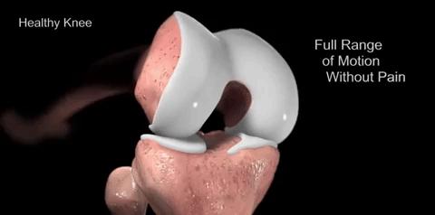 膝盖不好锻炼戴护膝好吗,膝盖也不好咋保护