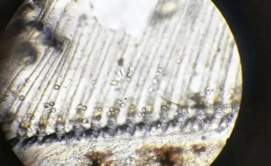 解决纤毛虫,纤毛虫防治技术