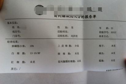 前列腺液检查有什么意义，为何很多医生都不做？看这里就知道了