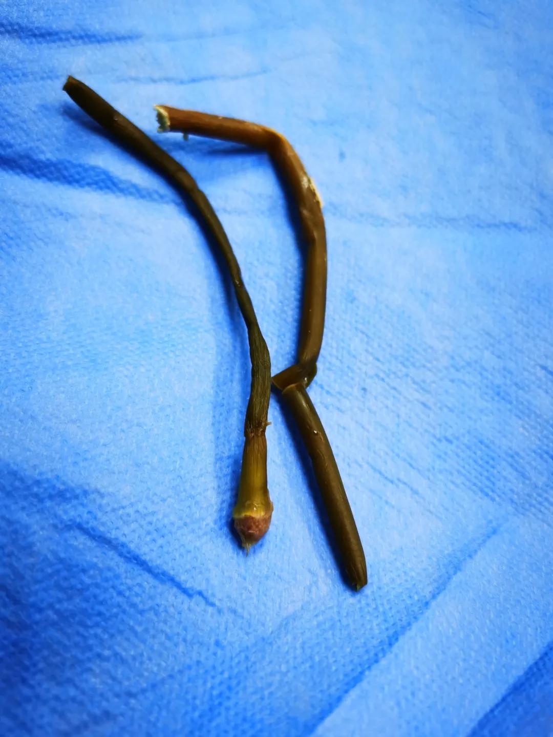 这一老一少为寻求刺激，对自己私密部位做了这事！结果双双进了医院……