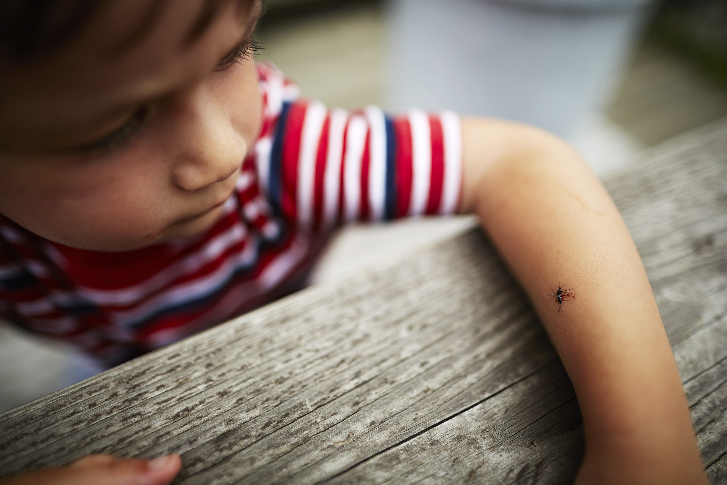 夏季蚊虫叮咬止痒的植物,蚊虫叮咬夏天如何防止