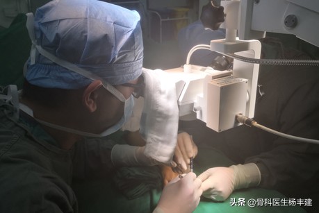 锁骨骨折后钢板断裂怎么办,股骨骨折钢板断裂原因分析