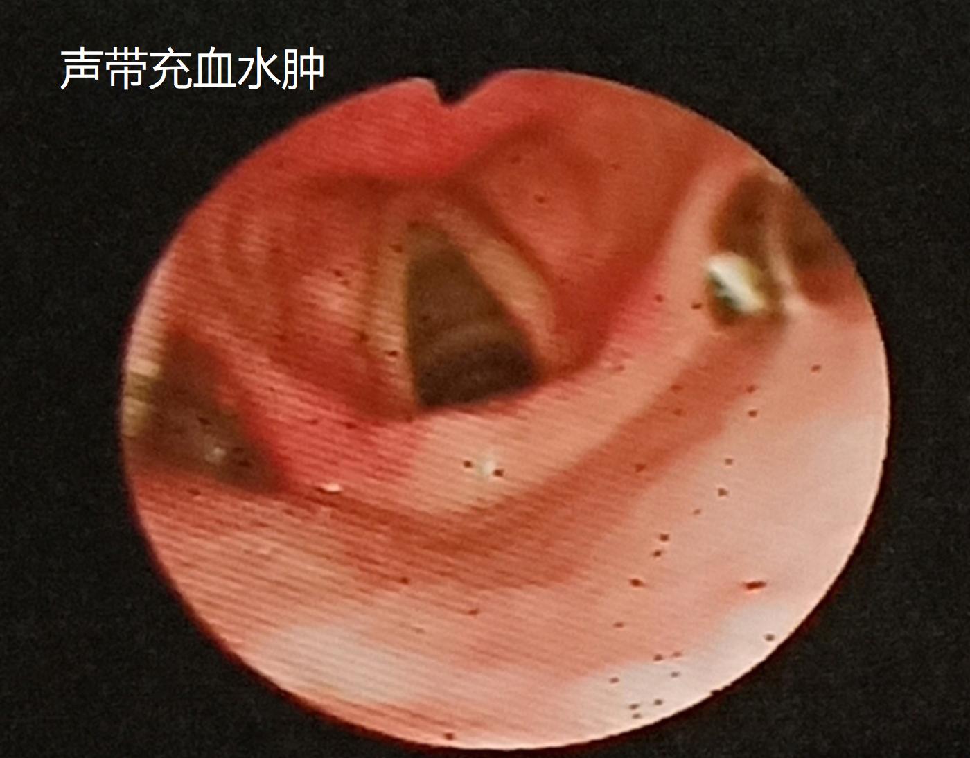 超强度工作，90后销售员“失声”了！保护嗓子有技巧，学了用得上