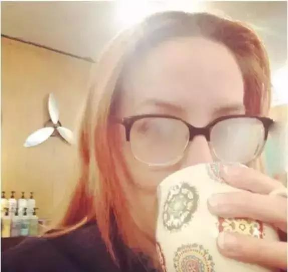 激光近视手术直视如何练习,激光近视手术做之前需要什么准备