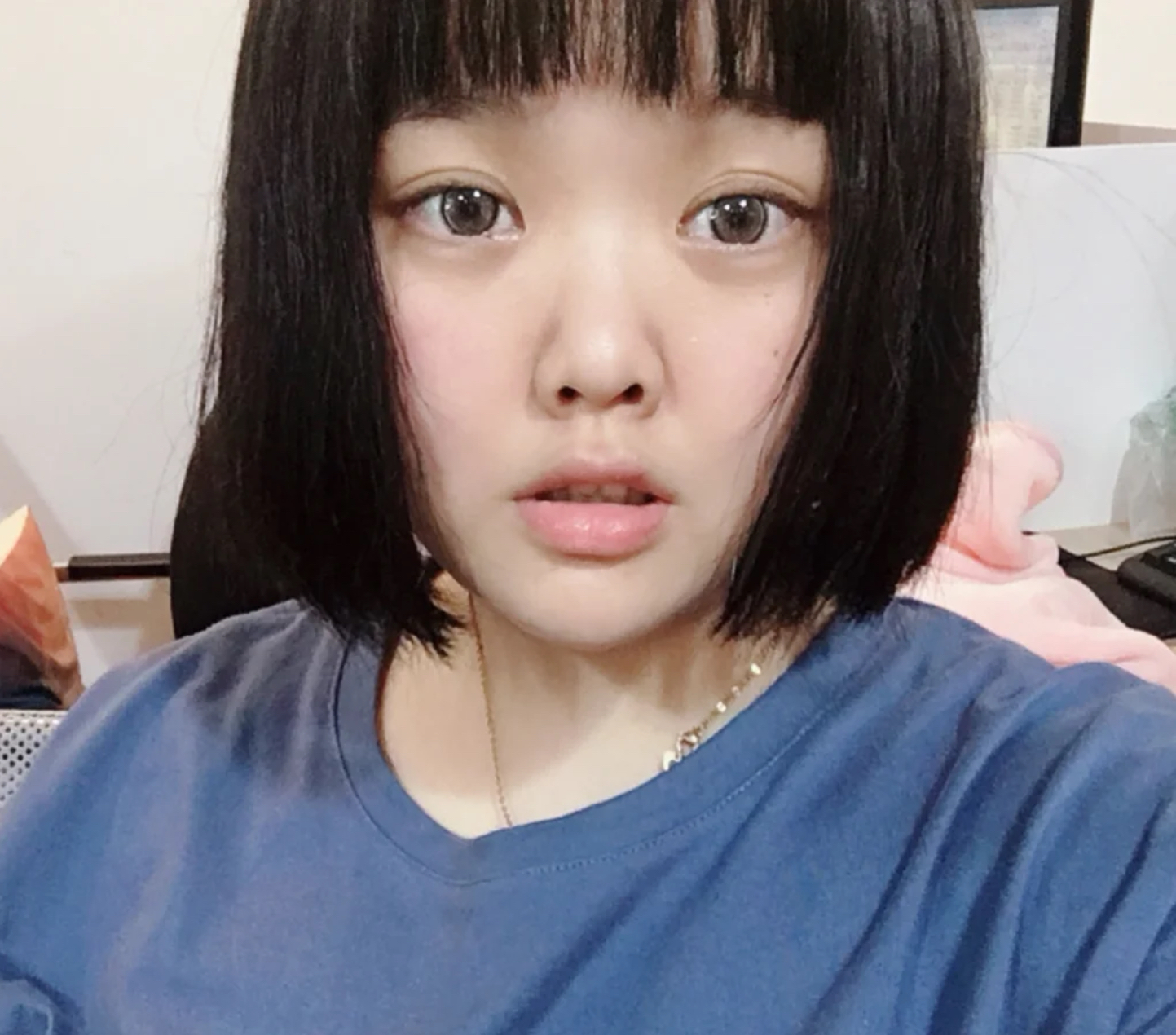 塌鼻梁蒜头鼻就一定丑吗,高鼻梁的蒜头鼻还能拯救吗