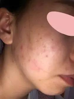 你的脸不是一般的脸,别让自己的脸成了护肤品试验田