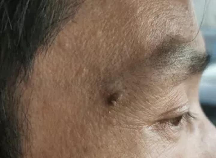 哪些部位长痣预示一生劳碌,痣的位置预示着什么