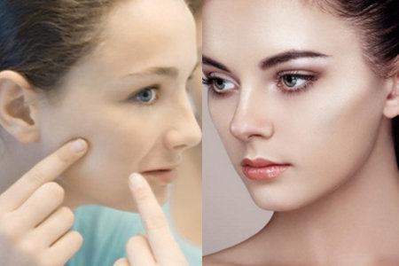 花了上万块祛斑有反弹的吗,激光祛斑反黑用什么产品能恢复好