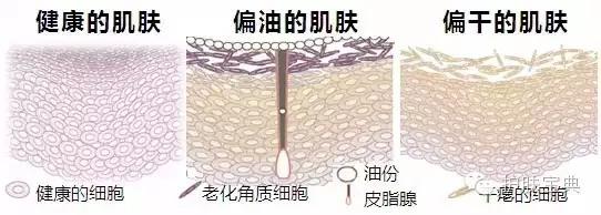 带你了解斑点产生原因,科普斑点治疗