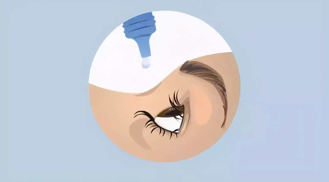 「掌健识」世界青光眼周：青光眼药物治疗之你问我答