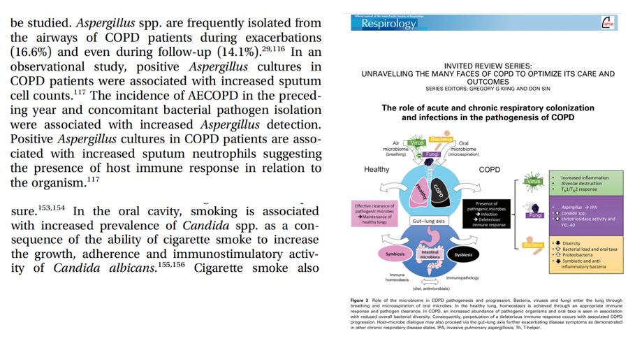 慢阻肺患者合并真菌感染,慢阻肺和真菌定植有关系吗