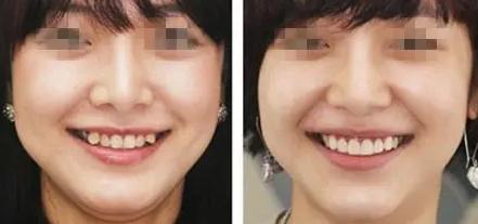 牙科诊所暴利视频,牙科暴利是真的