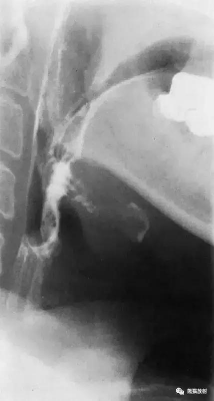 「收藏」11种消化道造影解剖图谱