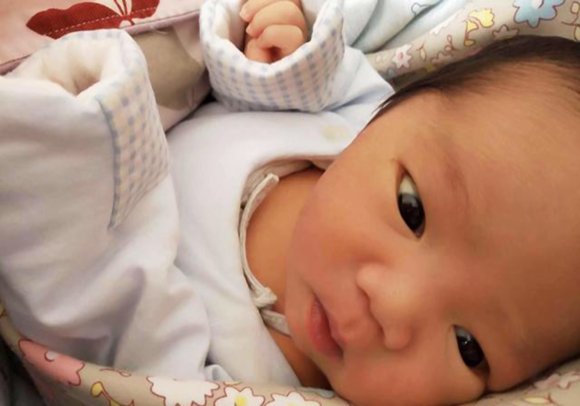 宝宝身上长有小黑刺怎么办,新生儿背部长黑刺怎么治