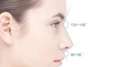 为什么做完鼻子看起来很假,鼻子做得很假是什么原因