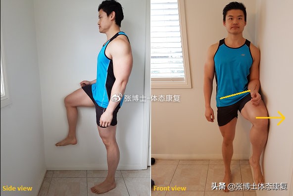 体态矫正小腿外翻,成年人x型腿加膝外翻怎么办