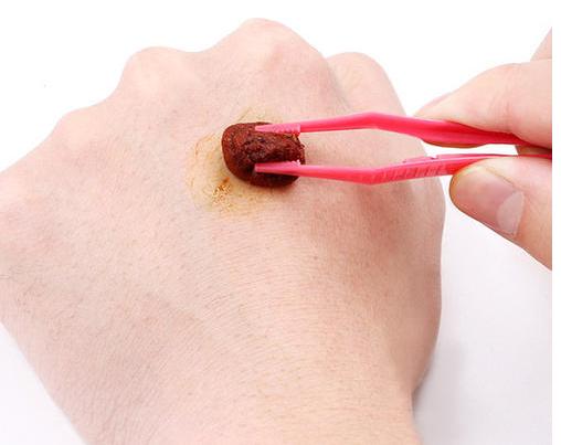 术后气管切口要如何护理？