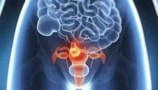 干细胞治疗卵巢早衰成功案例,干细胞治疗卵巢早衰的临床应用