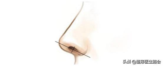 听说好看的鼻子都有一只海鸥在飞，你的海鸥飞得怎么样？