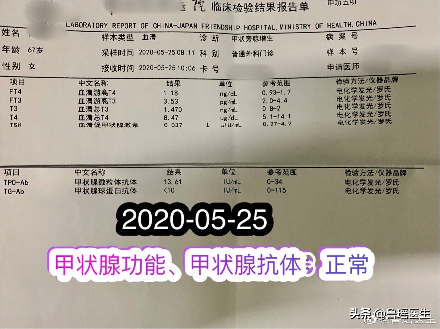 原发性甲旁亢临床症状,原发性甲旁亢为何多尿