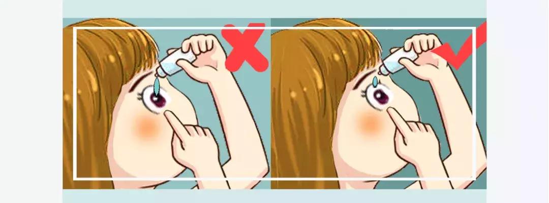 日本禁用眼药水有哪些,日本眼药水禁售名单