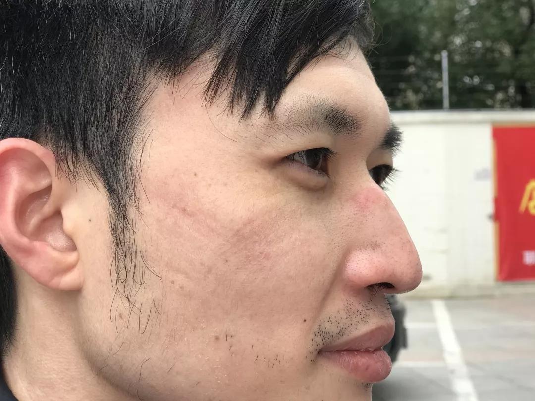 医院里的新冠患者越来越多,汉口医院特点