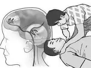 冷空气来袭慎防心脑血管病找上门,冷空气突袭