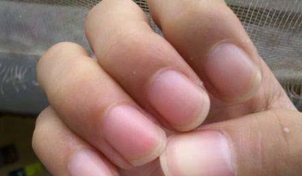 大拇指有月牙健康吗,大拇指有月牙代表什么