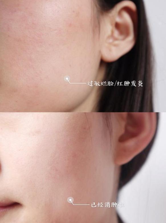 这面霜好用不踩雷，用过的都说好，让你做完美无瑕的瓷肌美人