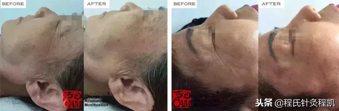 不要在脸上动任何刀,不要轻易在脸上动刀