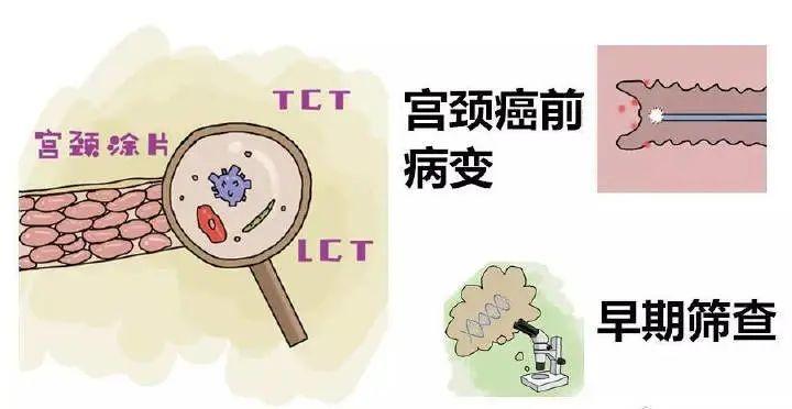 TCT、HPV报告单怎么看？一文教你读懂宫颈癌筛查结果
